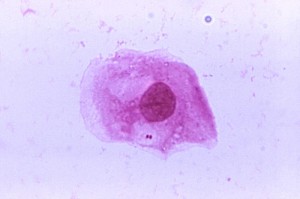 A photomicrograph of Neisseria meningitidis; Magnified 1125X.